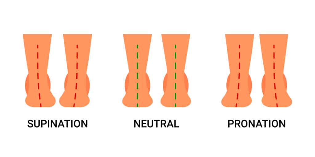 Diagram-of-feet-with-supination-neutral-and-pronation-pathologies-scaled